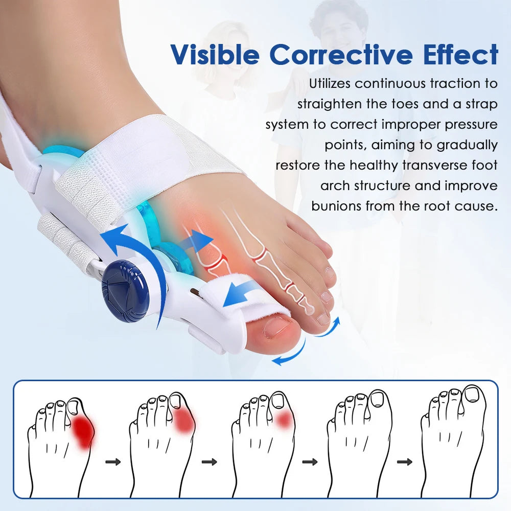 Adjustable Bunion Corrector with Cooling Pad – Orthopedic Toe Straightener